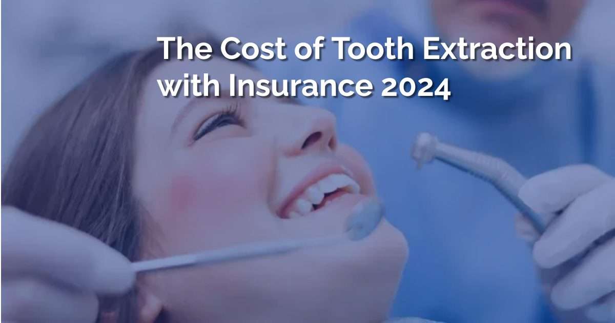 The Cost of Tooth Extraction with Insurance 2024